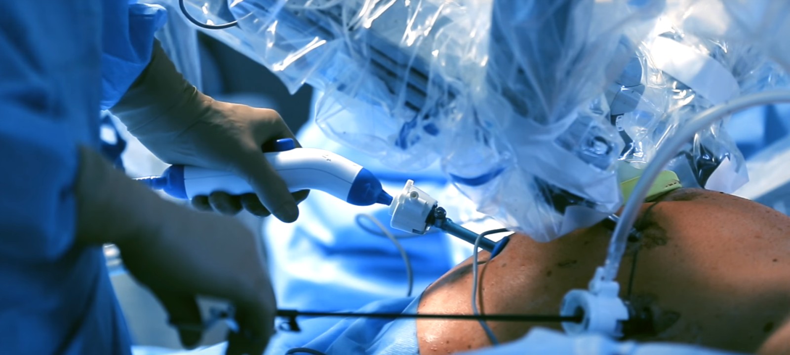 SMARTsurg - SMart weArable Robotic Teleoperated Surgery